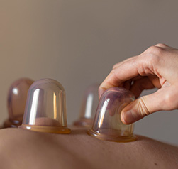 hijama cups